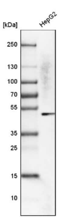 KRT23 Antibody, Novus Biologicals 25 &mu;L | Buy Online | Novus Biologicals | Fisher Scientific